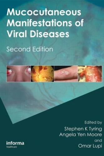 Бумажная книга «Mucocutaneous Manifestations of Viral Diseases: An Illustrated Guide to Diagnosis and Management» - фото №1