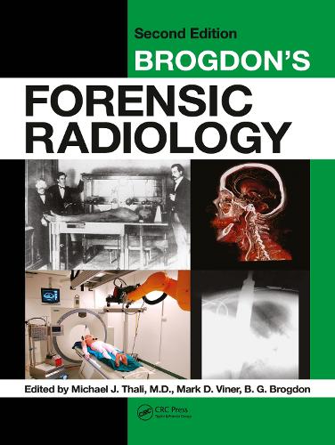 Паперова книга «Brogdon's Forensic Radiology» - фото №1