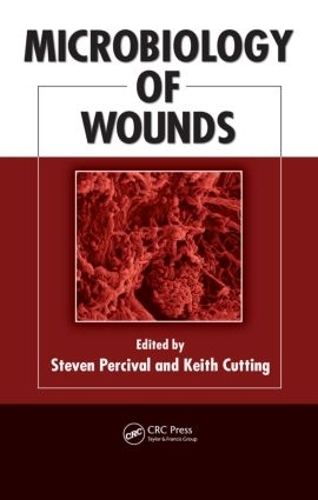 Бумажная книга «Microbiology of Wounds» - фото №1