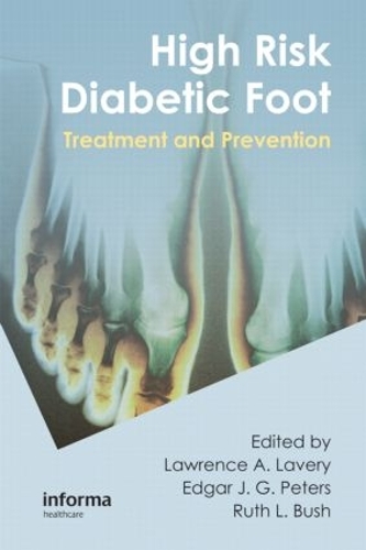 Бумажная книга «High Risk Diabetic Foot: Treatment and Prevention» - фото №1
