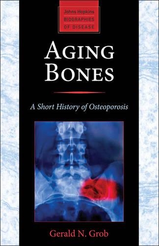 Паперова книга «Aging Bones: A Short History of Osteoporosis», автор Джеральд Н. Гроб - фото №1