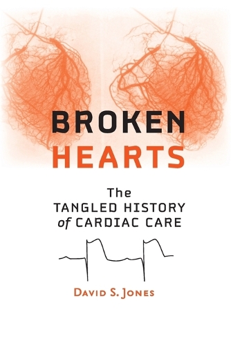 Бумажная книга «Broken Hearts: The Tangled History of Cardiac Care», автор Дэвид С. Джонс - фото №1