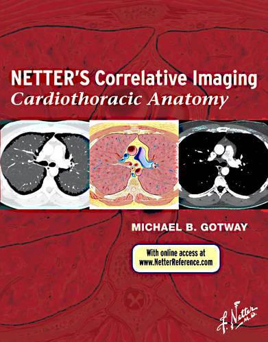 Бумажная книга «Netter's Correlative Imaging: Cardiothoracic Anatomy», автор Майкл Б. Готуэй - фото №1