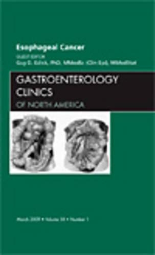 Паперова книга «Esophageal Cancer, An Issue of Gastroenterology Clinics», автор Гі Д. Еслік - фото №1