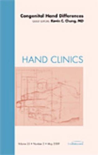 Бумажная книга «Congenital Hand Differences, An Issue of Hand Clinics», автор Кевин К. Чанг - фото №1