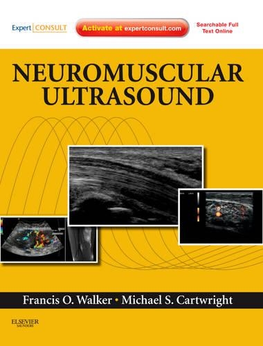 Паперова книга «Neuromuscular Ultrasound: Expert Consult - Online and Print», авторів Френсіс Вокер, Майкл С. Картрайт - фото №1