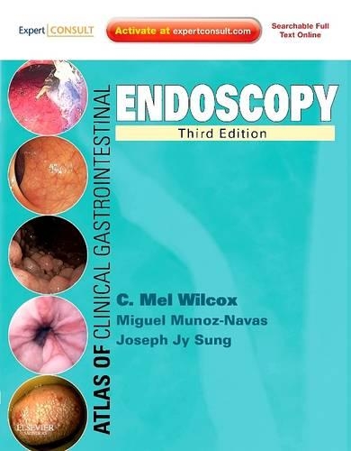 Паперова книга «Atlas of Clinical Gastrointestinal Endoscopy: Expert Consult - Online and Print», авторів Чарльз Мелберн Вілкокс, Джозеф Джі Сун, Мігель Муньос-Навас - фото №1