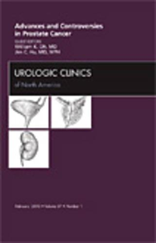 Бумажная книга «Advances and Controversies in Prostate Cancer, An Issue of Urologic Clinics», авторов Джеймс С. Ху, Уильям К. О - фото №1