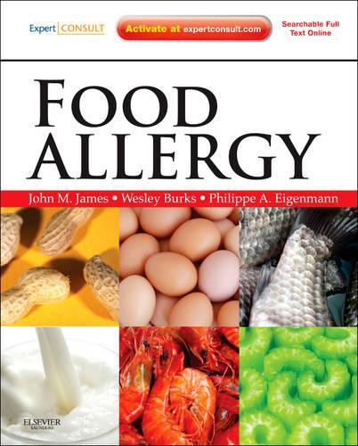 Бумажная книга «Food Allergy: Expert Consult Basic», авторов A Уесли Беркс, Джон М Джеймс, Филипп Эйгенманн - фото №1