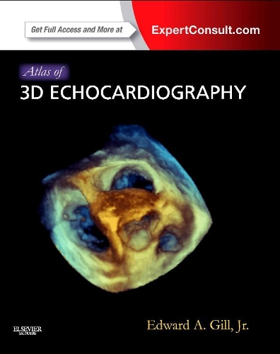 Бумажная книга «Atlas of 3D Echocardiography: Expert Consult - Online and Print», автор Эдвард А. Гилл - фото №1