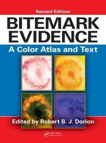 [object Object] «Bitemark Evidence: A Color Atlas and Text, 2nd Edition» - фото №1