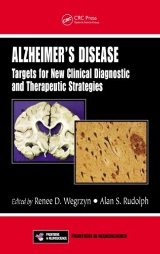 Паперова книга «Alzheimer's Disease: Targets for New Clinical Diagnostic and Therapeutic Strategies» - фото №1