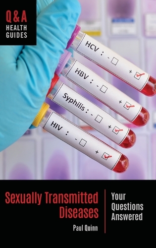 Бумажная книга «Sexually Transmitted Diseases: Your Questions Answered», автор Пол Куинн - фото №1