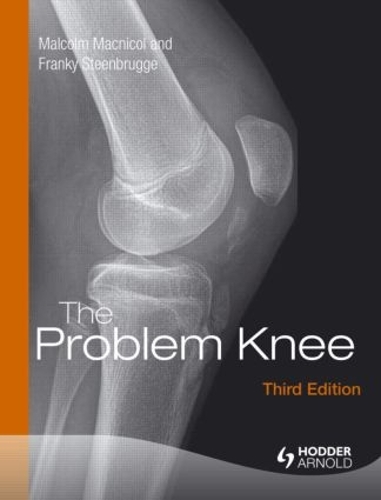 Паперова книга «The Problem Knee», авторів Френкі Стінбрюгге, Малкольм Макнікол - фото №1