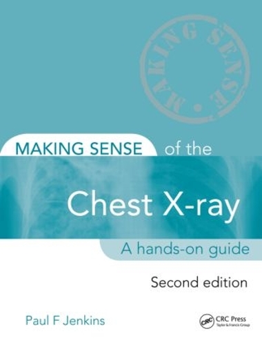 [object Object] «Making Sense of the Chest X-ray: A hands-on guide», автор Пол Дженкинс - фото №1