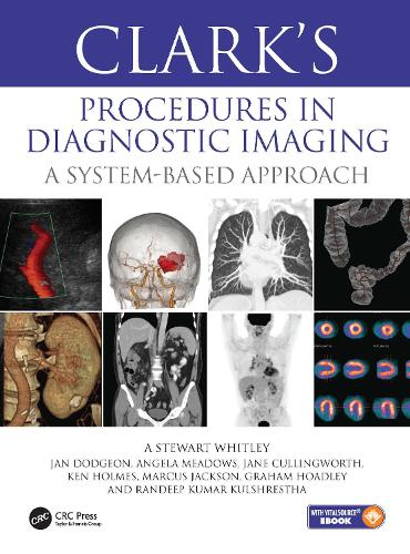 Паперова книга «Clark’s Procedures in Diagnostic Imaging: A System-Based Approach», авторів А Стюарт Вітлі, Анжела Медоуз, Грем Ходлі, Ян Доджон, Джейн Каллінгворт, Кен Холмс, Маркус Джексон, Рендіп Кулшреста - фото №1