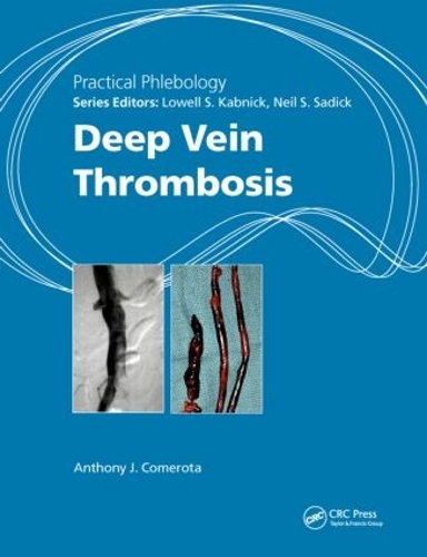 Бумажная книга «Practical Phlebology: Deep Vein Thrombosis», автор Энтони Дж. Комерота - фото №1