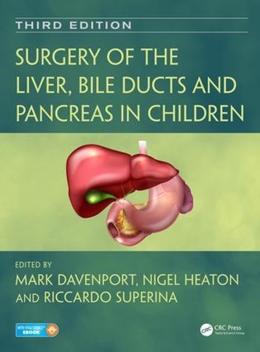 Бумажная книга «Surgery of the Liver, Bile Ducts and Pancreas in Children» - фото №1
