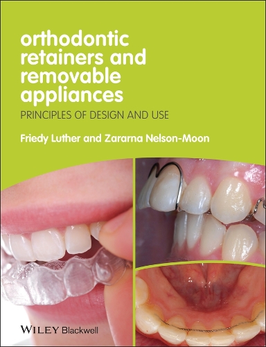 Паперова книга «Orthodontic Retainers and Removable Appliances: Principles of Design and Use», авторів Фріді Лютер, Зара Нельсон-Мун - фото №1