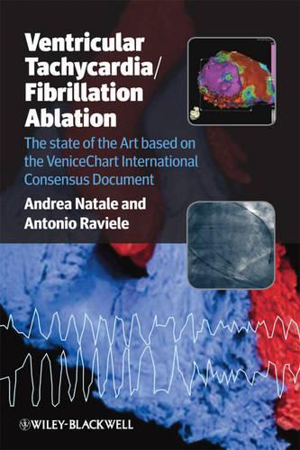 Бумажная книга «Ventricular Tachycardia / Fibrillation Ablation: The state of the Art based on the VeniceChart International Consensus Document», авторов Андреа Натале, Антонио Равиэле - фото №1