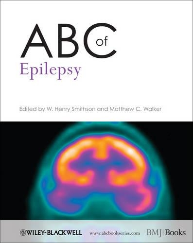 Бумажная книга «ABC of Epilepsy», авторов Мэтью К. Уокер, У. Генри Смитсон - фото №1