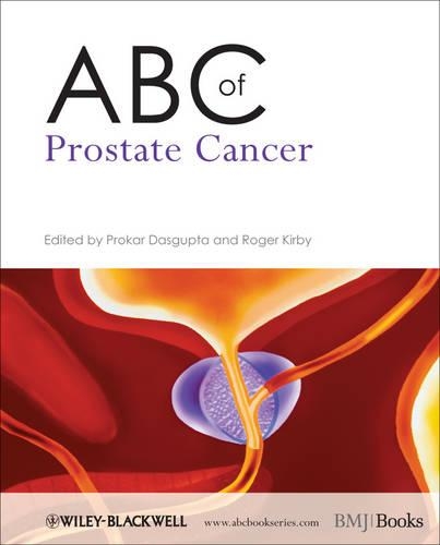 Бумажная книга «ABC of Prostate Cancer», авторов Прокар Дасгупта, Роджер С. Кирби - фото №1