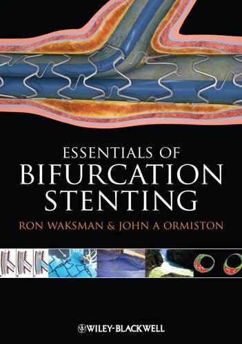 Бумажная книга «Bifurcation Stenting», авторов Джон А. Ормистон, Рон Ваксман - фото №1