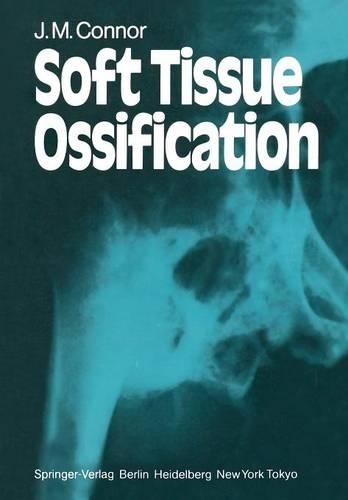 Паперова книга «Soft Tissue Ossification», автор Дж. М. Коннор - фото №1