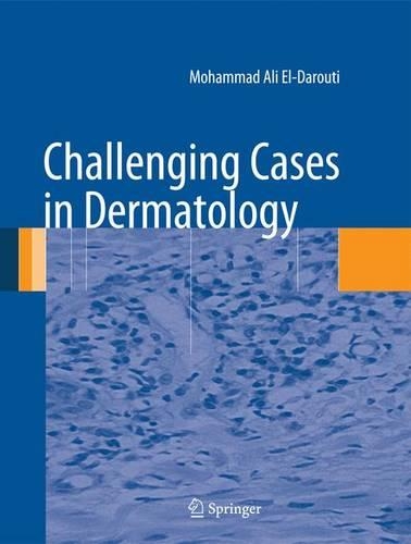 Бумажная книга «Challenging Cases in Dermatology», автор Мохаммад Али Эль-Дарути - фото №1