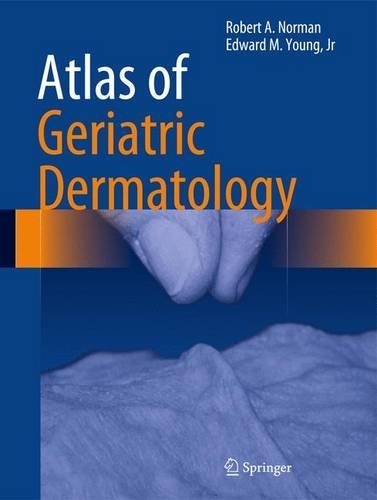 Бумажная книга «Atlas of Geriatric Dermatology», авторов Эдвард М. Янг-младший, Роберт А. Норман - фото №1