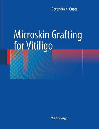 Бумажная книга «Microskin Grafting for Vitiligo», автор Девендра К Гупта - фото №1