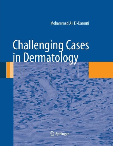 Паперова книга «Challenging Cases in Dermatology», автор Мохаммед Алі Ель-Даруті - фото №1