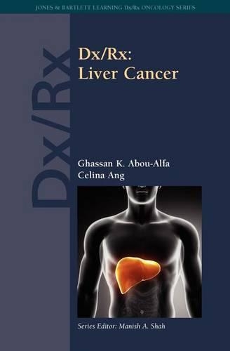 Паперова книга «Dx/Rx: Liver Cancer: Liver Cancer», авторів Селіна Анг, Гассан К. Абу-Альфа - фото №1