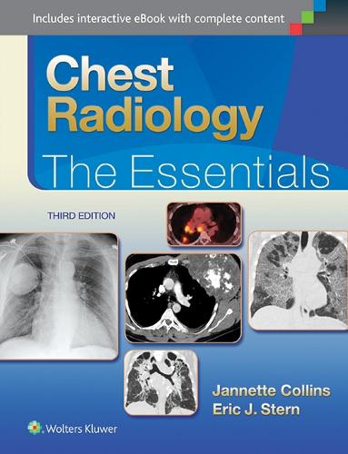 Paper book «Chest Radiology: The Essentials», authors Eric J. Stern, Janette Collins - фото №1
