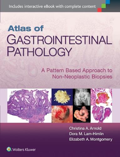 Бумажная книга «Atlas of Gastrointestinal Pathology: A Pattern Based Approach to Non-Neoplastic Biopsies», авторов Кристина Арнольд, Дора Лам-Химлин, Элизабет А. Монтгомери - фото №1