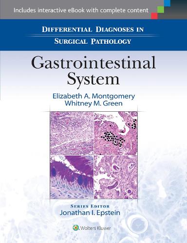 Бумажная книга «Differential Diagnoses in Surgical Pathology: Gastrointestinal System», авторов Элизабет А. Монтгомери, Уитни М. Грин - фото №1
