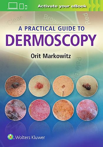 Паперова книга «A Practical Guide to Dermoscopy», автор Орит Марковіц - фото №1