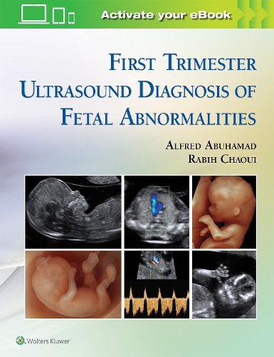 Paper book «First Trimester Ultrasound Diagnosis of Fetal Abnormalities», authors Alfred Z Abuhamad, Rabih Chaoui - фото №1