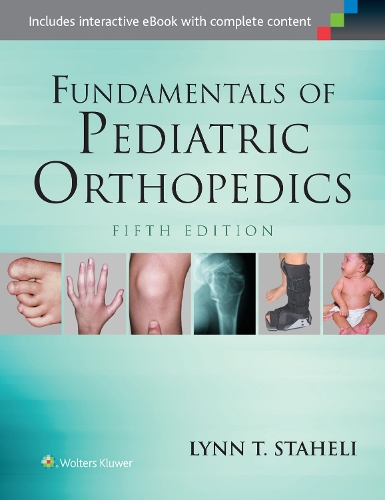 Бумажная книга «Fundamentals of Pediatric Orthopedics», автор Линн Т. Стахели - фото №1