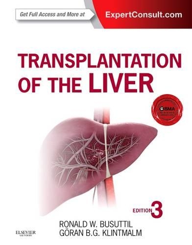 Бумажная книга «Transplantation of the Liver», авторов Горан Б. Клинтмальм, Рональд В. Бусуттил - фото №1