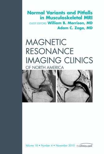 Бумажная книга «Normal Variants and Pitfalls in Musculoskeletal MRI, An Issue of Magnetic Resonance Imaging Clinics», авторов Адам К. Зога, Уильям Б. Моррисон - фото №1