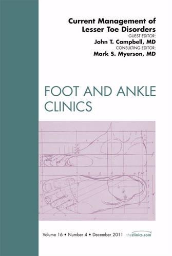 Бумажная книга «Current Management of Lesser Toe Disorders, An Issue of Foot and Ankle Clinics», авторов Джон Х. Кэмпбелл, Марк С. Майерсон - фото №1