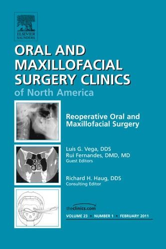 Бумажная книга «Reoperative Oral and Maxillofacial Surgery, An Issue of Oral and Maxillofacial Surgery Clinics», авторов Луис Вега, Руй Фернандеш - фото №1