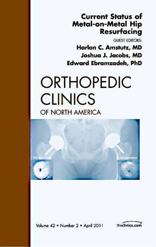 Бумажная книга «Current Status of Metal-on-Metal Hip Resurfacing, An Issue of Orthopedic Clinics», авторов Эдди Эбрамзаде, Харлан Амстутц, Джошуа Джейкобс - фото №1