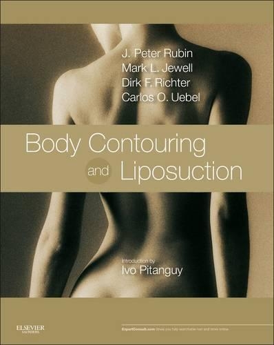 Паперова книга «Body Contouring and Liposuction: Expert Consult - Online and Print», авторів Карлос Оскар Уебель, Дірк Ріхтер, Дж. Пітер Рубін, Марк Л. Джуелл - фото №1
