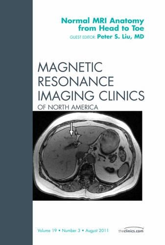 Бумажная книга «Normal MR Anatomy from Head to Toe, An Issue of Magnetic Resonance Imaging Clinics», автор Питер С. Лю - фото №1