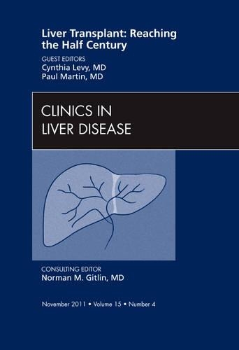 Бумажная книга «Liver Transplant: Reaching the half century, An Issue of Clinics in Liver Disease», автор Синтия Леви - фото №1