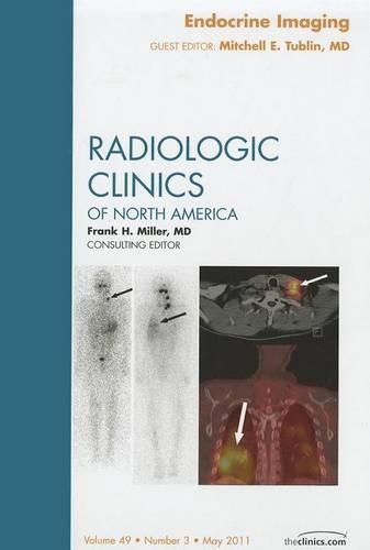 Паперова книга «Endocrine Imaging, An Issue of Radiologic Clinics of North America», автор Мітчелл Е. Тублін - фото №1