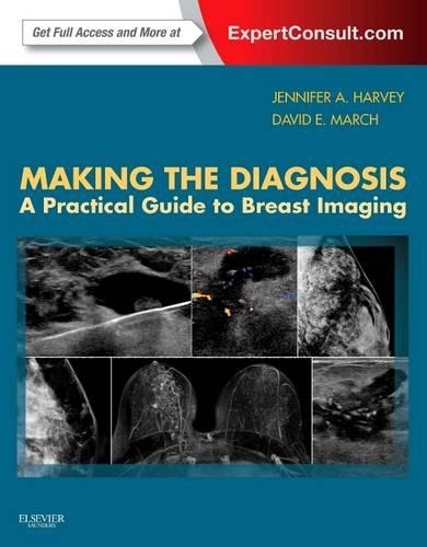 Бумажная книга «Making the Diagnosis: A Practical Guide to Breast Imaging: Expert Consult - Online and Print», авторов Дэвид Э Марч, Дженнифер Харви - фото №1