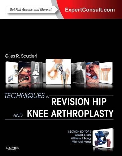 Бумажная книга «Techniques in Revision Hip and Knee Arthroplasty», автор Джайлз Р. Скудери - фото №1